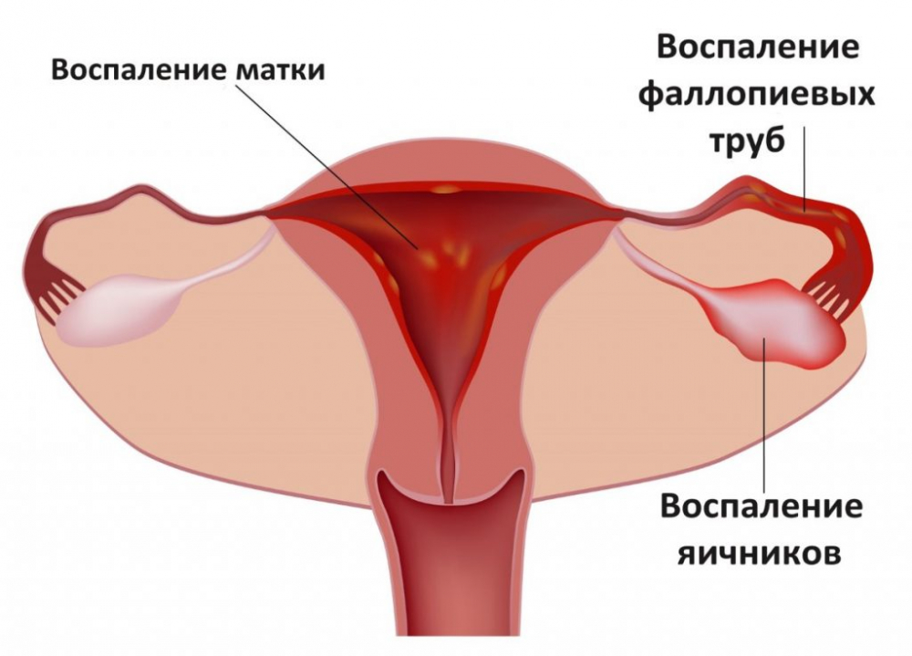 что такое онкоцитология в гинекологии